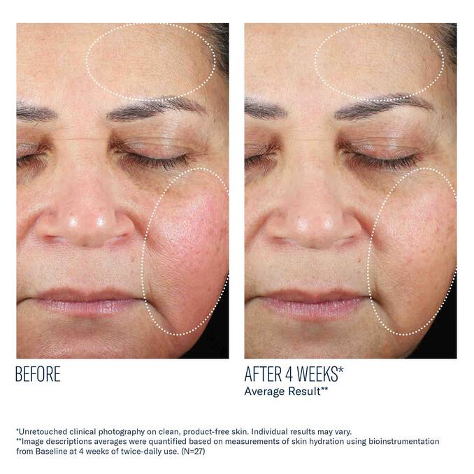 Skinbetter Science Trio Luxe Moisture Treatment
