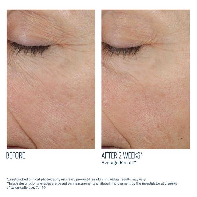 Skinbetter Science Trio Rebalancing Moisture Treatment