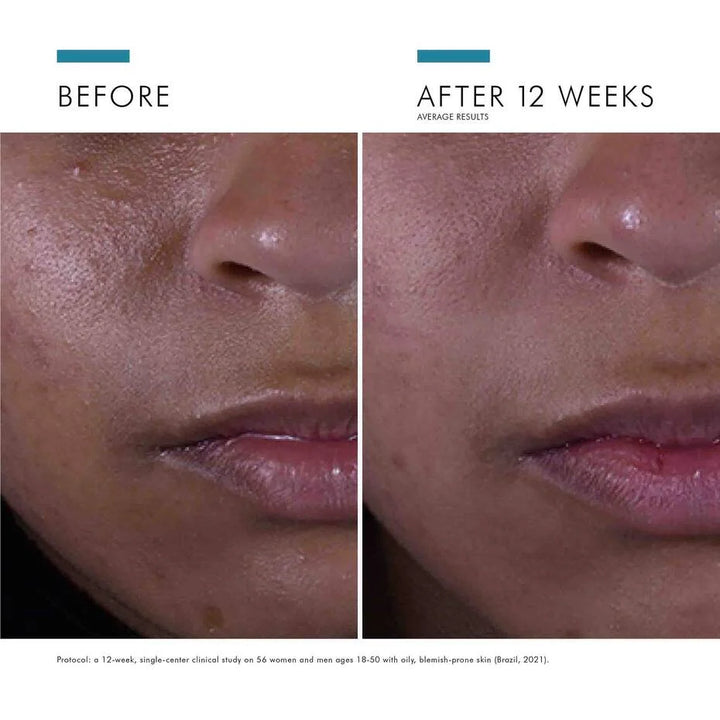 SkinCeuticals Silymarin CF + gåva värde 650:-